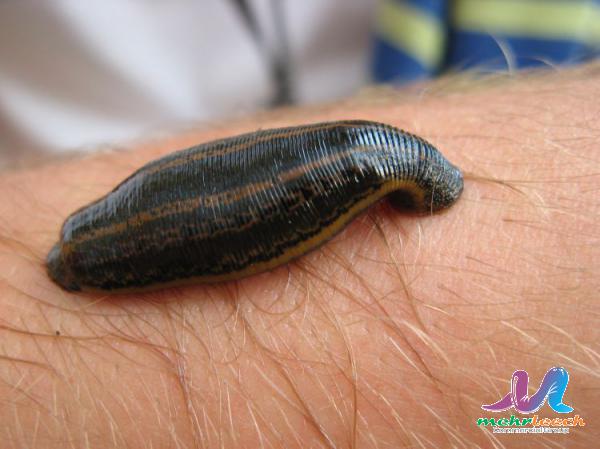 Is leech therapy painful?