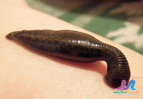 What happens to leeches after leech therapy?