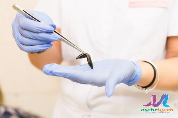 Superior leech therapy global market