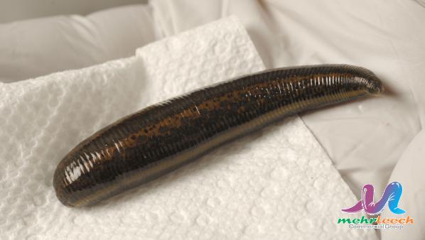 How long does leech therapy last?