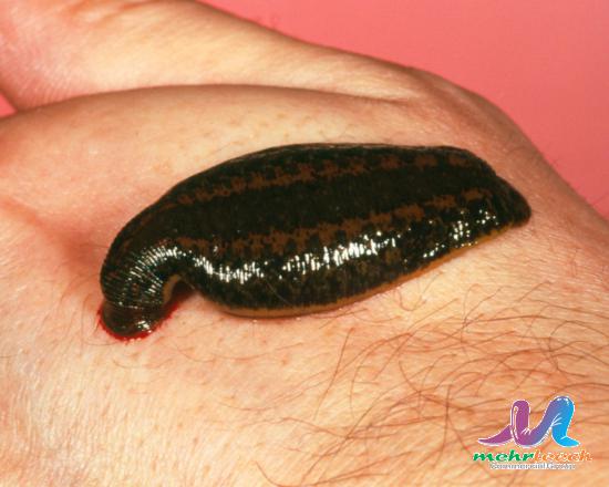 Is leech therapy painful?