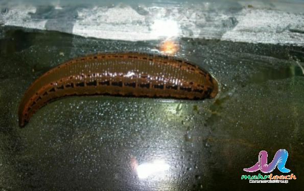 What is Leech Therapy?