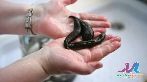 World trade statistics of leech therapy