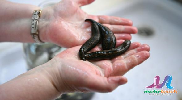 Leech therapy global market