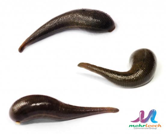 How long does leech therapy last?