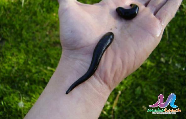 Global demand for leech therapy