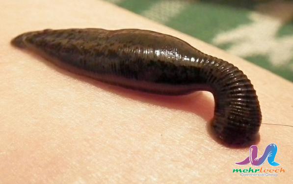 Bulk marketing of leech therapy