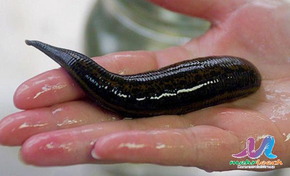 Rational price of leech therapy