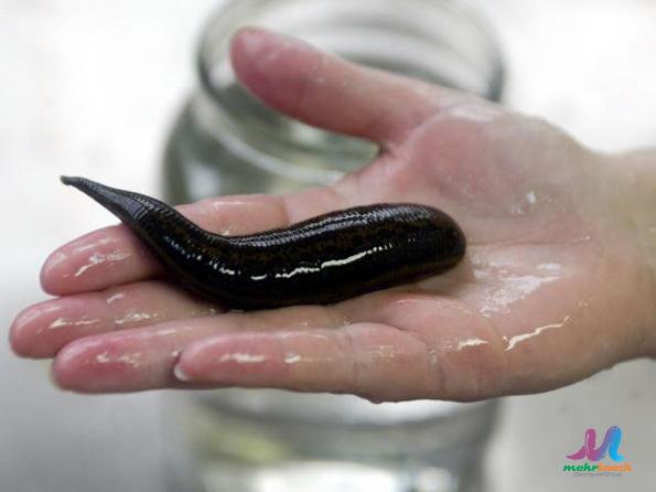 What Is a Medical Grade Leech?