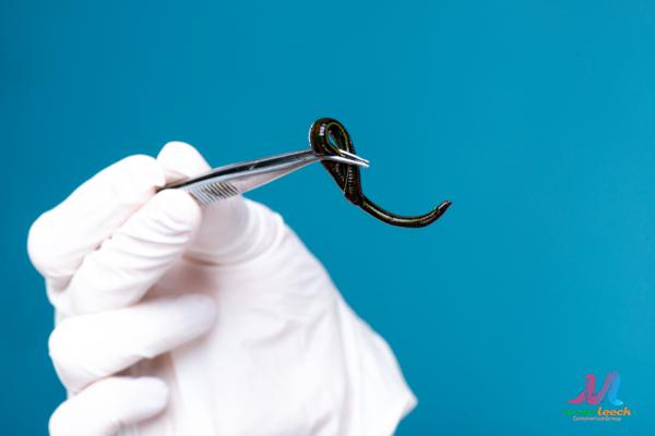 Do Surgeons Still Use Leeches?