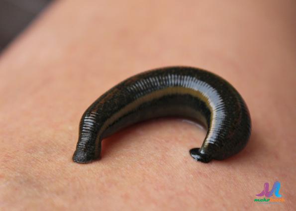 Preventing Eye Inflammation with Medical Leeches